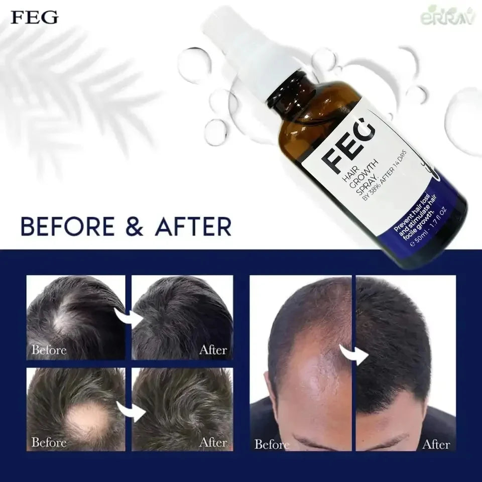FEG Plus Hair Growth Serum Spray – 50ml (For Men & Women)