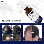FEG Plus Hair Growth Serum Spray – 50ml (For Men & Women)