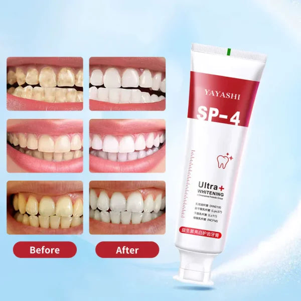 SP-4 Ultra+ Probiotic Whitening Toothpaste – Advanced Oral Care with Natural Probiotics