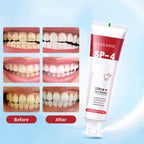SP-4 Ultra+ Probiotic Whitening Toothpaste – Advanced Oral Care with Natural Probiotics